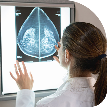 MBC Clinical Trial