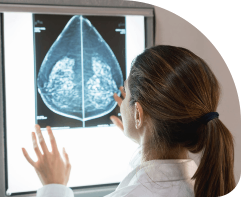 MBC Clinical Trial